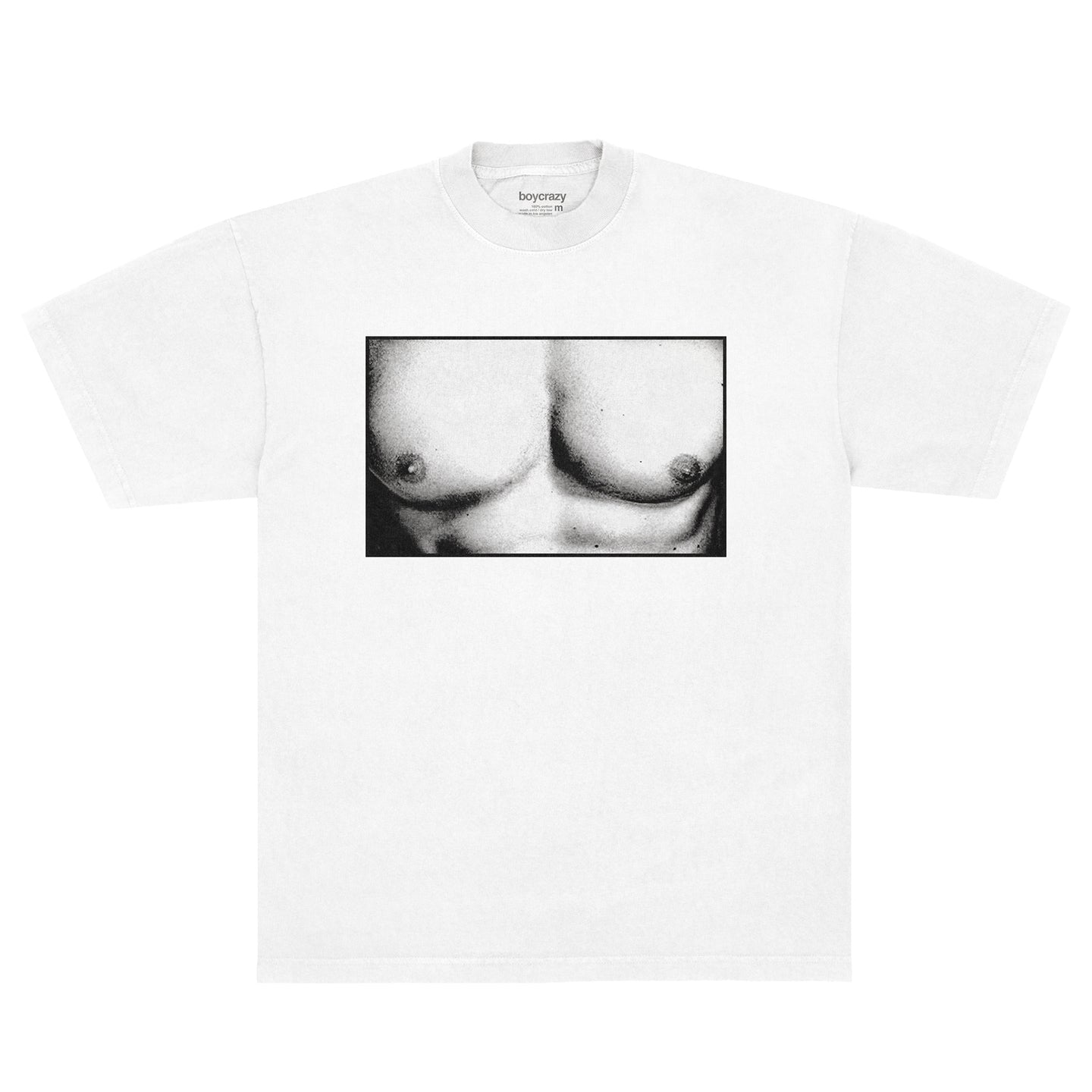 PECS TEE